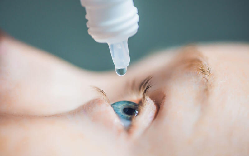 An image of a patient at Boca Raton's Correct Vision family eye care center uses eye drops to treat a normal eye condition. 